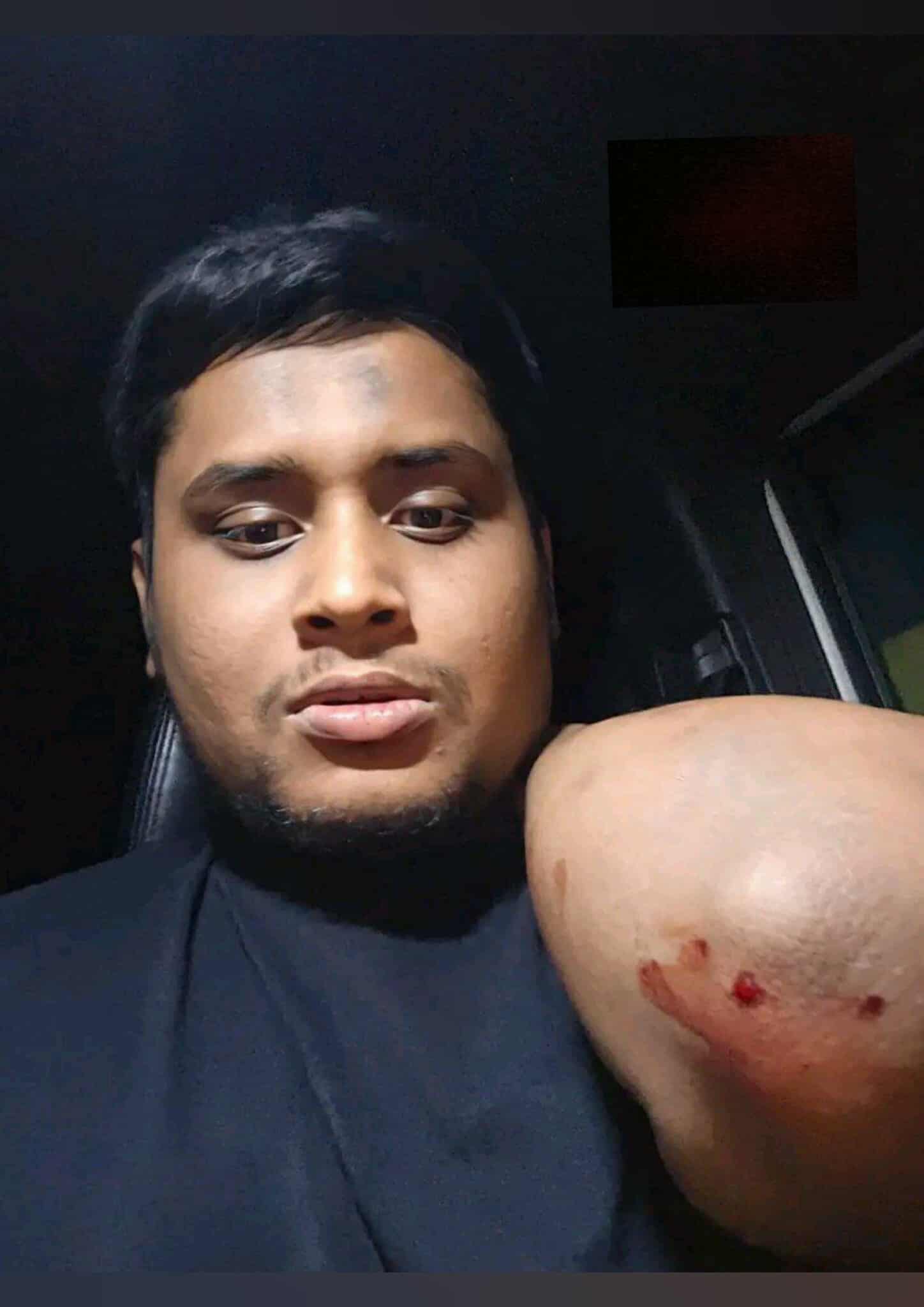 গাজীপুরে হাসনাত আব্দুল্লাহর ওপর হামলার অভিযোগ