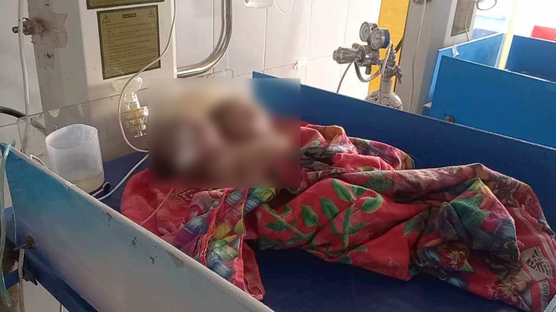 পঞ্চগড় জন্ম নিল জোড়া মাথার নবজাতক, ২ ঘণ্টা পর মৃত্যু